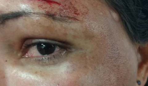 Mulher gravida de 8 meses é espancada pelo esposo no São José 2