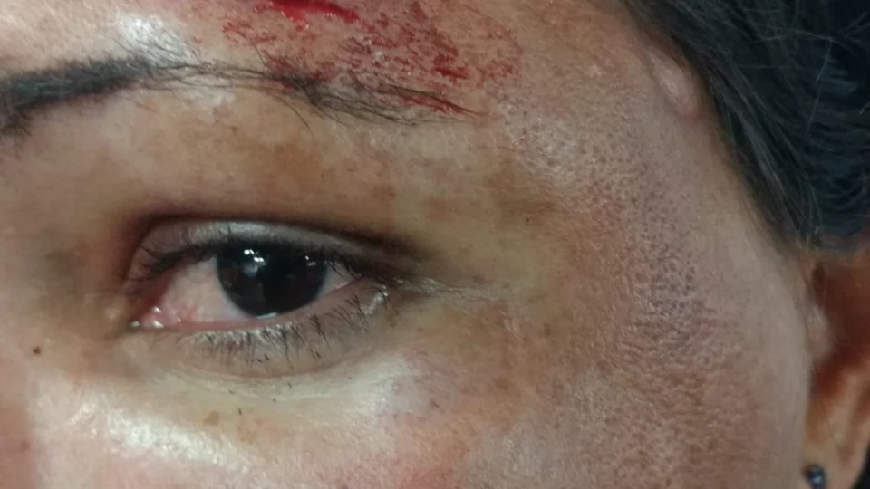 Mulher gravida de 8 meses é espancada pelo esposo no São José 2