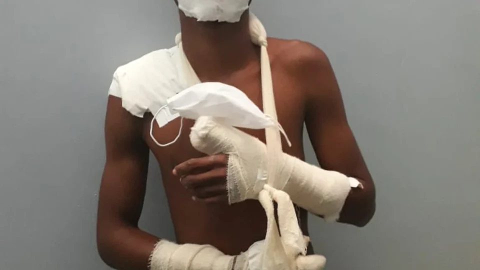 Durante assalto bandido golpeia idoso com terçado e acaba se ferindo