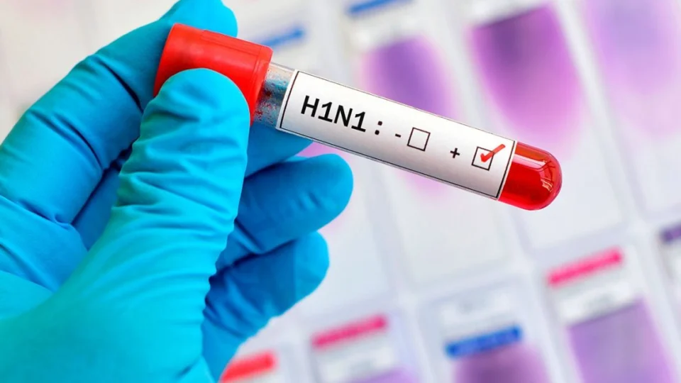 Fundação de Vigilância em Saúde notifica 62 casos de H1N1 no Amazonas