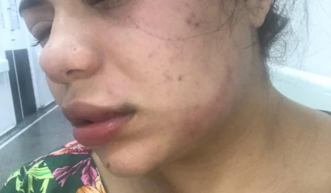 Médico agride esposa, em desespero ela se joga ao rio