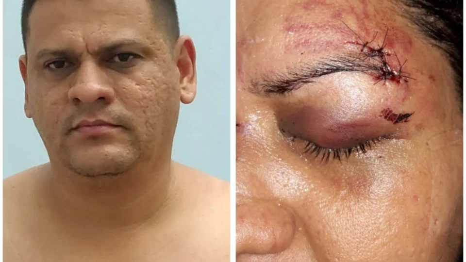 Homem preso por agredir ex-mulher, é solto em Audiência de Custódia