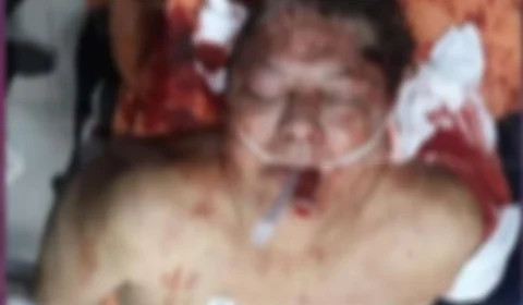 Após receber voz de prisão, ex-presidente do Perú comete suicídio