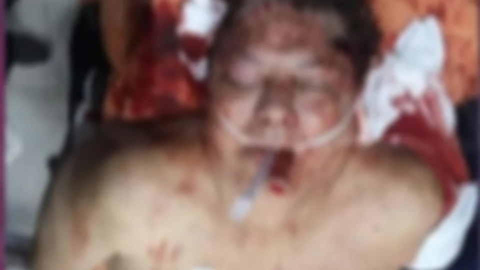 Após receber voz de prisão, ex-presidente do Perú comete suicídio