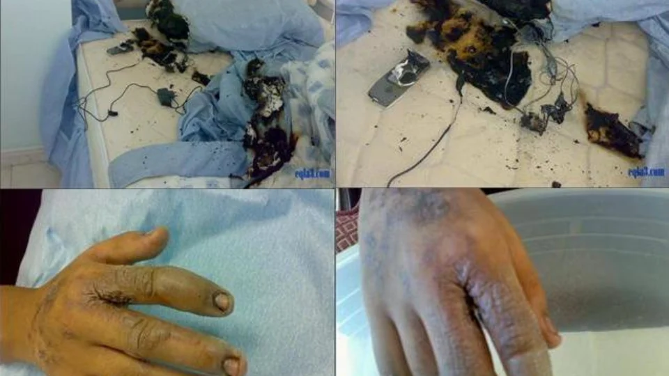 Saiba quais medidas tomar para evitar incêndio em sua residência; Veja o vídeo