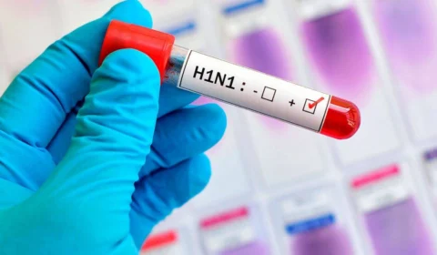 27ª SRAG afirma que há 24 dias o AM não apresenta registros de H1N1