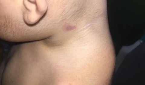 Criança de 1 ano é agredida em creche do bairro São Francisco