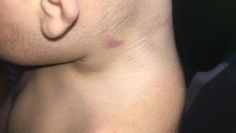 Criança de 1 ano é agredida em creche do bairro São Francisco