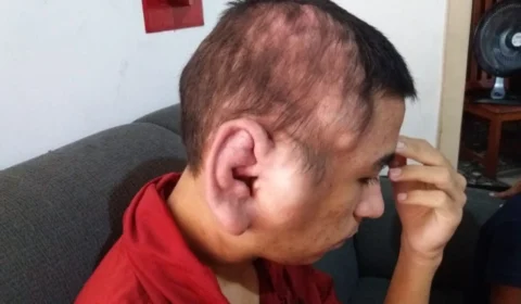 Jovem com doença desconhecida pede ajuda ao Imediato para iniciar tratamento