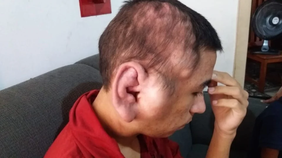 Jovem com doença desconhecida pede ajuda ao Imediato para iniciar tratamento