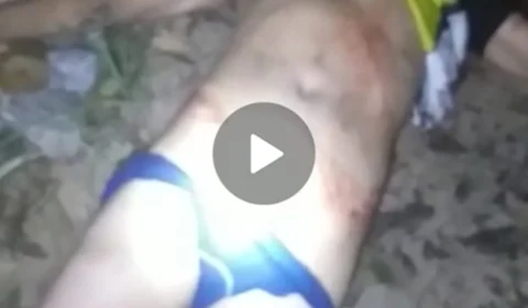 Bandido atira para matar vítima e acerta cabeça de comparsa