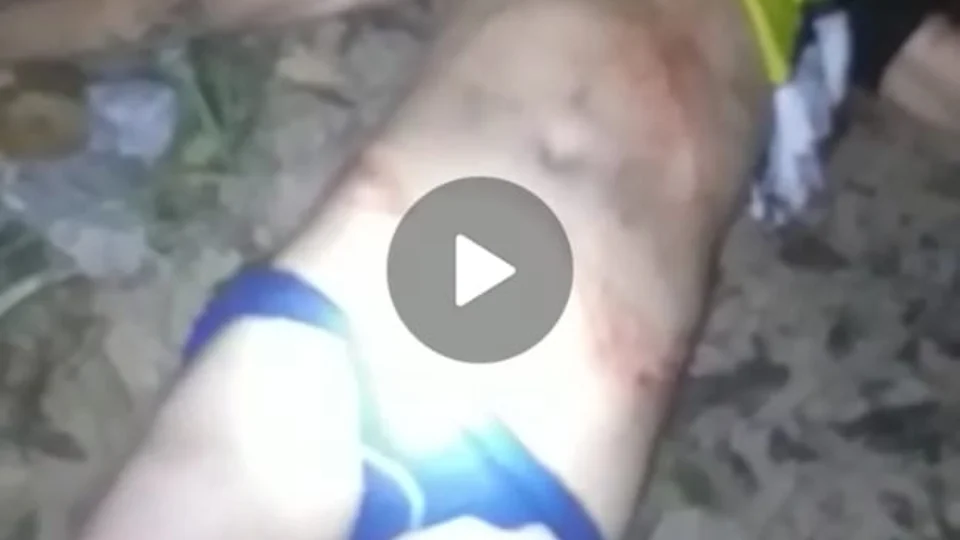 Bandido atira para matar vítima e acerta cabeça de comparsa