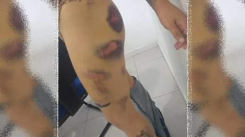 Tortura: homem é preso por agredir ex-namorada durante 5 horas e ainda obrigá-la a comer fezes de animais