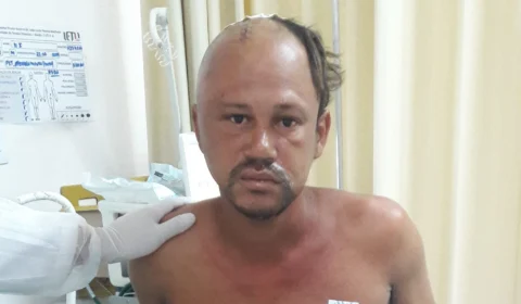 HPS João Lúcio procura familiares de paciente vítima de atropelamento