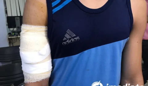 Atleta é esfaqueado durante assalto a ônibus da linha 448 na Cidade Nova