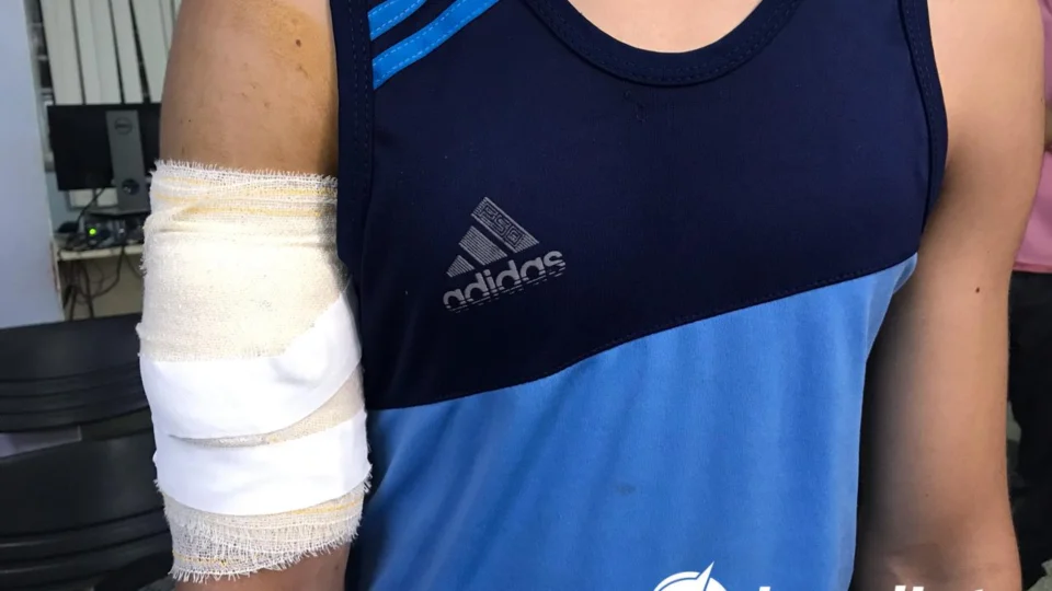 Atleta é esfaqueado durante assalto a ônibus da linha 448 na Cidade Nova