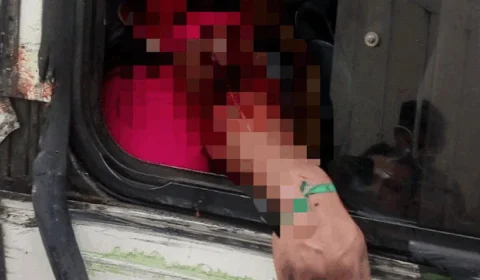 Homem corre risco de ter braço amputado após ser atingido por ônibus