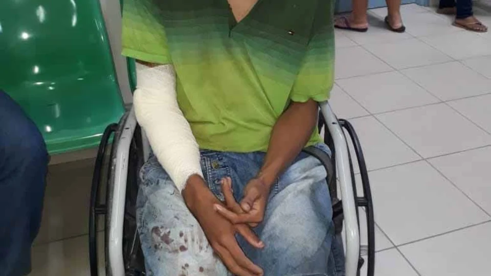 Assaltante é atropelado por justiceiro no Jorge Texas