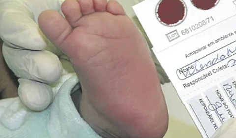 Teste do pezinho deverá ser controlado nas unidades de saúde de Manaus