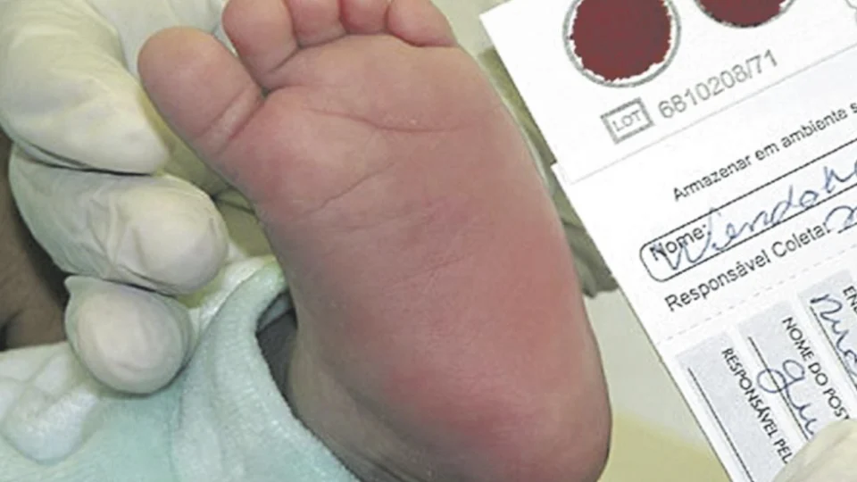 Teste do pezinho deverá ser controlado nas unidades de saúde de Manaus