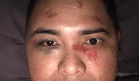 Após final homens tentam invadir vestiário do Amazonas FC e agridem camareiro