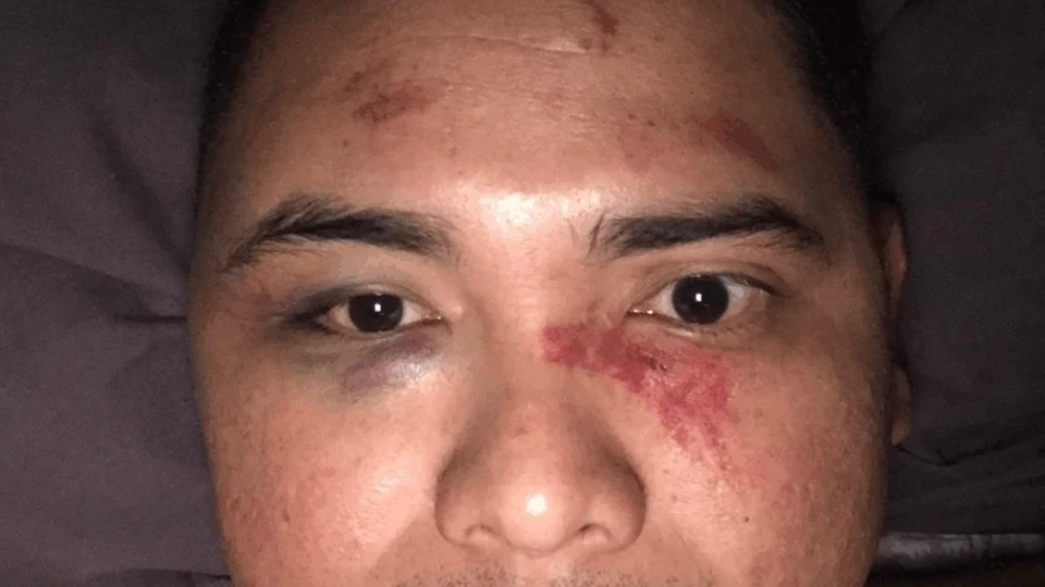 Após final homens tentam invadir vestiário do Amazonas FC e agridem camareiro