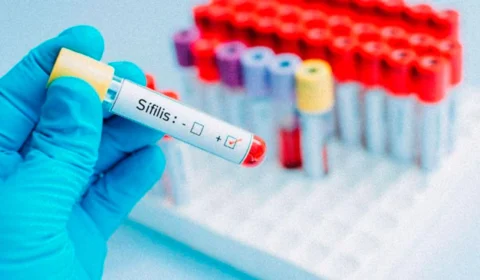 Ponta Negra recebe ação de combate à sífilis