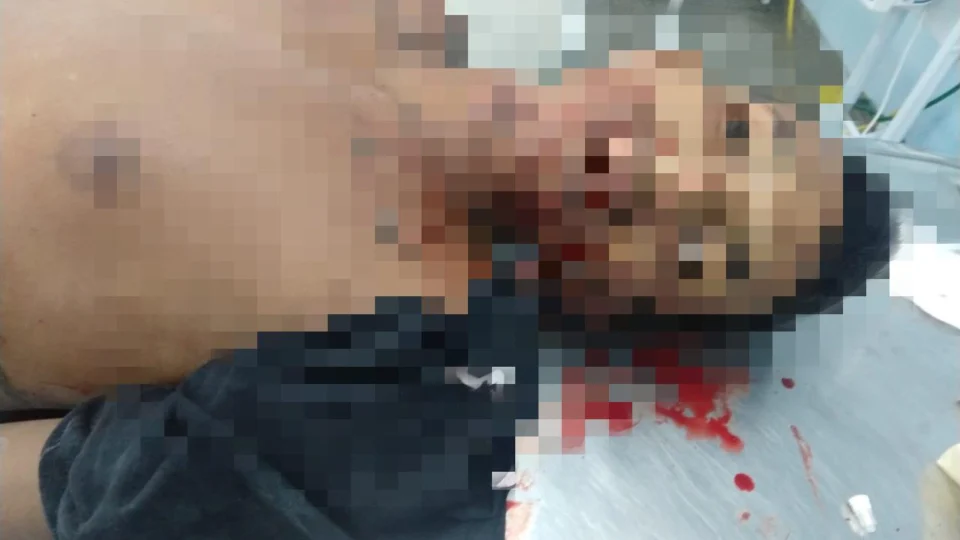 Homem é executado com 6 tiros por assassinos encapuzados na zona Norte de Manaus