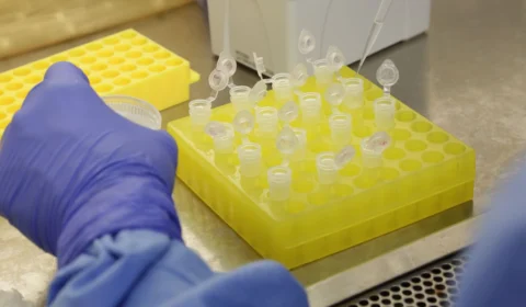 Amazonas confirma mais duas mortes por Covid-19 e total de óbitos no estado aumenta para 5