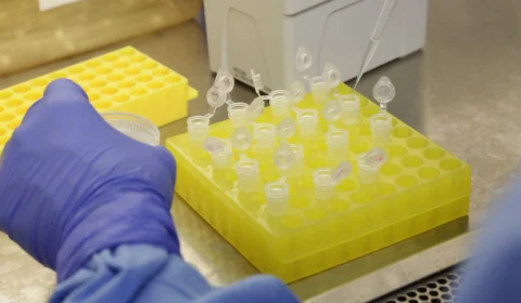 Brasil ultrapassa 100 mil casos confirmados de covid-19