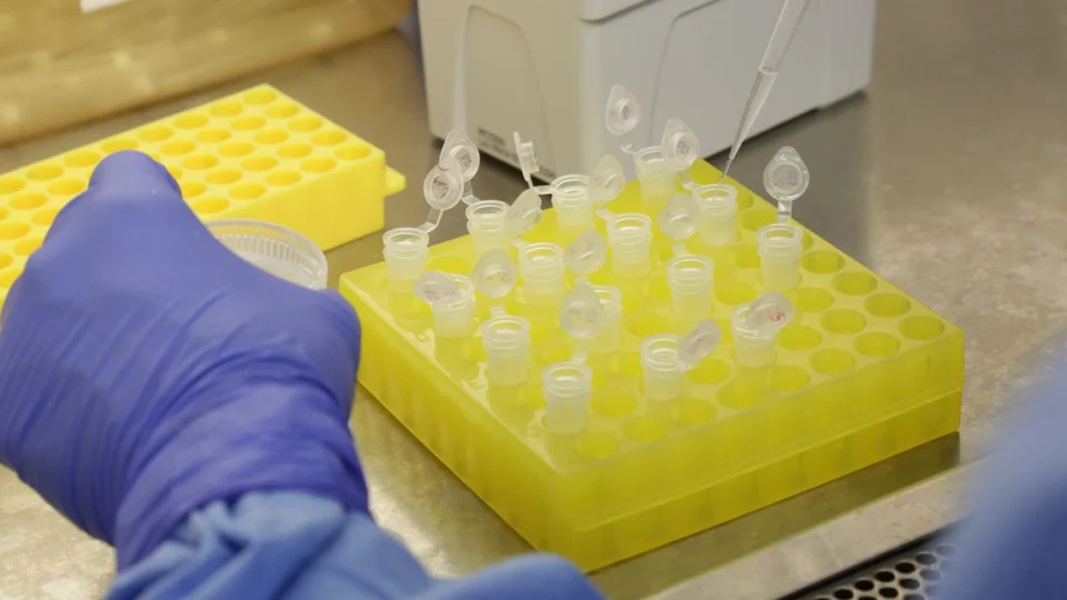 Brasil ultrapassa 100 mil casos confirmados de covid-19