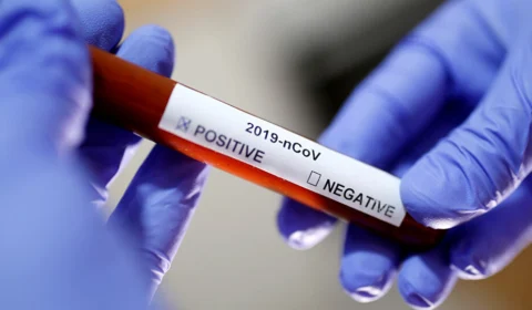 Cientistas da Catalunha desenvolvem medicamento contra novo coronavírus