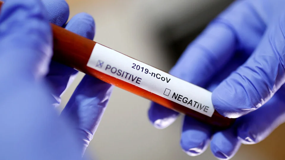 Cientistas da Catalunha desenvolvem medicamento contra novo coronavírus