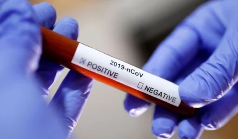 Rio de Janeiro tem segundo caso confirmado do novo coronavírus