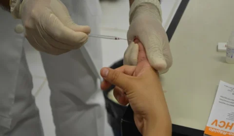 FVS-AM alerta população para identificar tuberculose durante a pandemia de Covid-19