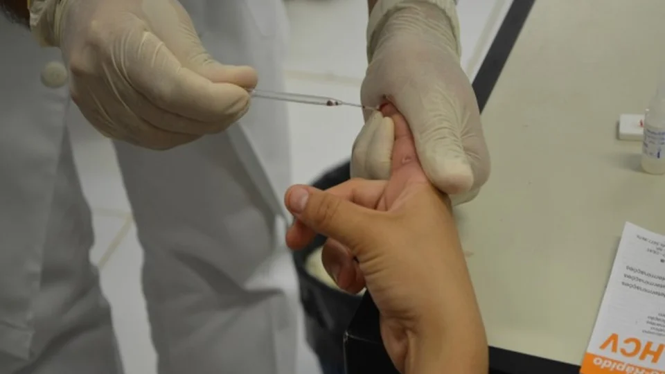 FVS-AM alerta população para identificar tuberculose durante a pandemia de Covid-19