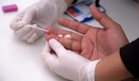 Segundo paciente curado do HIV segue sem sinais do vírus após 30 meses