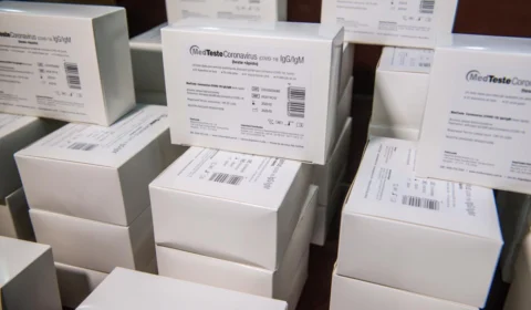 Covid-19: Amazonas recebe primeiro lote de testes rápidos adquiridos pelo governo do estado