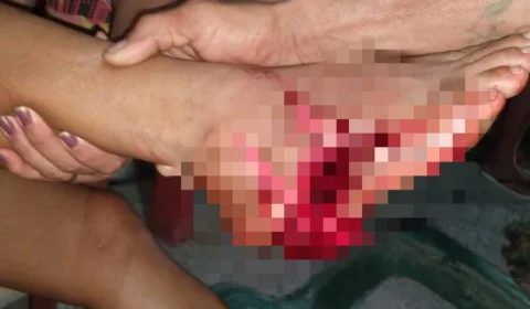 Mulher é atingida com tiro de fuzil no pé durante intenso tiroteio no Bairro da União