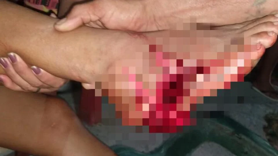 Mulher é atingida com tiro de fuzil no pé durante intenso tiroteio no Bairro da União