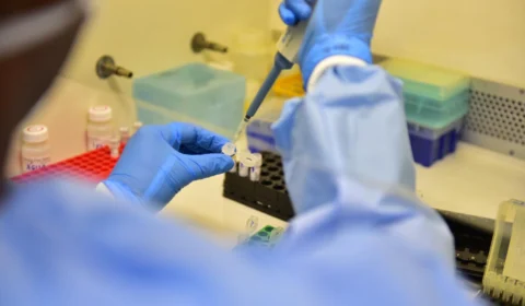 Amazonas amplia rede de diagnóstico de Covid-19 por biologia molecular