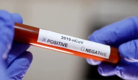 Covid-19: FVS divulga Boletim da Covid-19 no Amazonas, neste sábado (14)