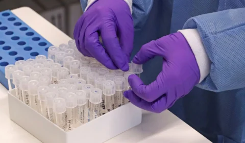 Pandemia : pesquisas buscam entender coronavírus e apontar formas de combate