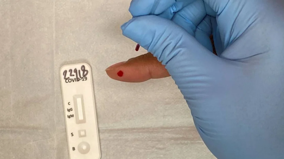 Covid-19: Boletim da FVS-AM aponta 175.298 casos confirmados no Amazonas