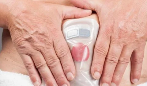 Justiça determina que Estado garanta dignidade dos pacientes ostomizados no Amazonas