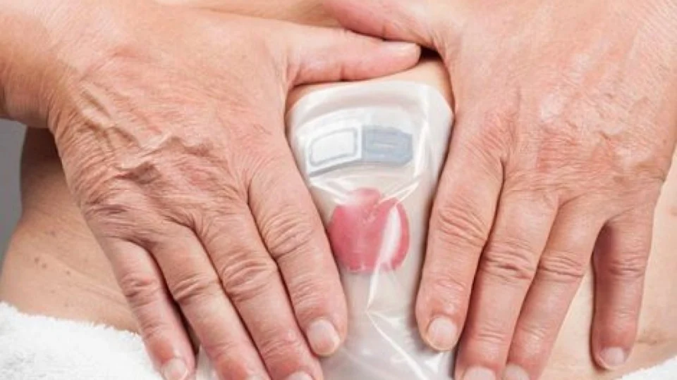 Justiça determina que Estado garanta dignidade dos pacientes ostomizados no Amazonas