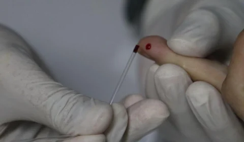 FVS-AM orienta farmácias sobre testes rápidos para Covid-19 e estabelece sistema de notificação de casos