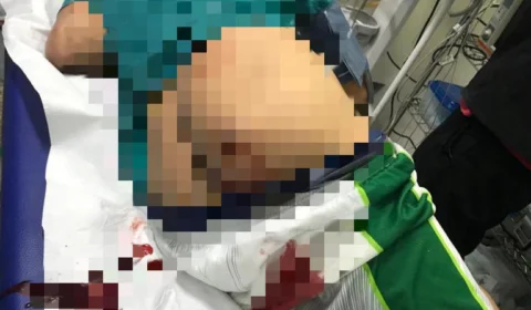 Homem leva tiro nas nádegas durante tiroteio no Nossa Senhora de Fátima