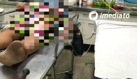 Mulher leva tiro no braço durante assalto no Jorge Teixeira