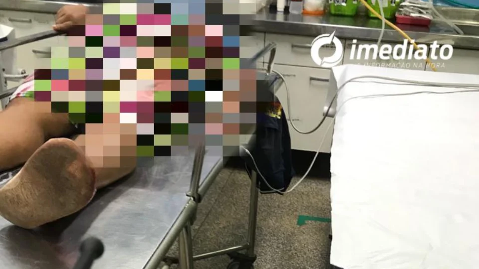 Mulher leva tiro no braço durante assalto no Jorge Teixeira